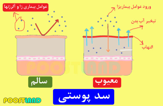 سد پوستی (Skin Barrier)