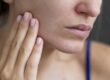 پوست چرب دهیدراته (dehydrated oily skin)