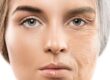 علائم و نشانه های پیری پوست