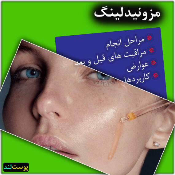 مزونیدلینگ چیست مزونیدلینگ چیست