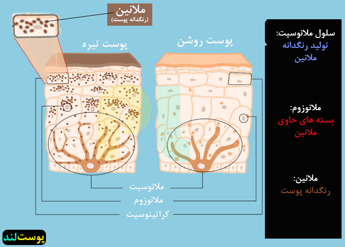 تفاوت پوست روش و تیره